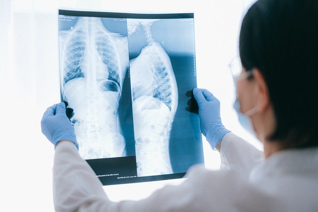 imagem de jovem doutora olhando um raio-x